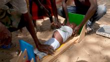 A malnourished child being measured in Ileret, northern Kenya.