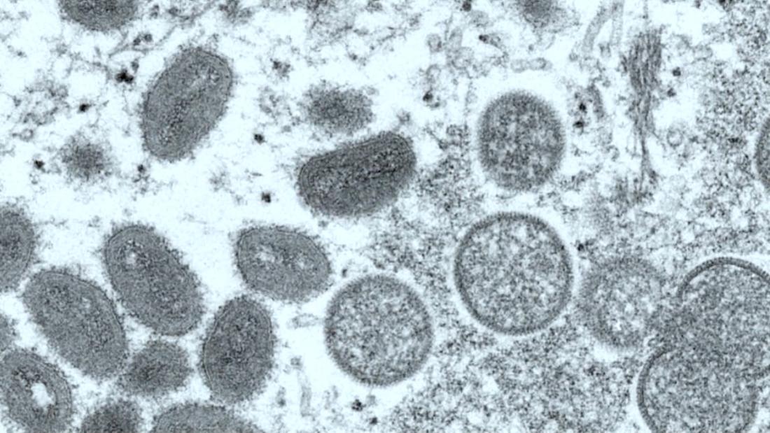 Kematian pertama AS dari monkeypox dikonfirmasi di Los Angeles County