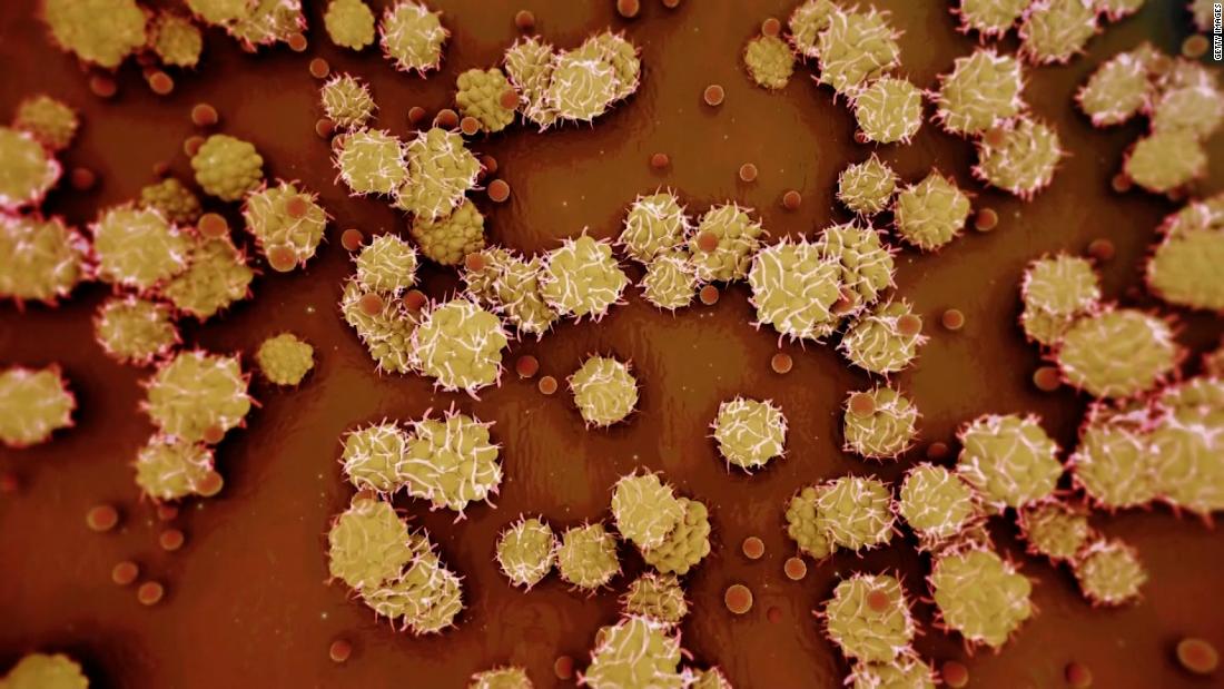 Biden administration declares the monkeypox outbreak a public health emergency – CNN