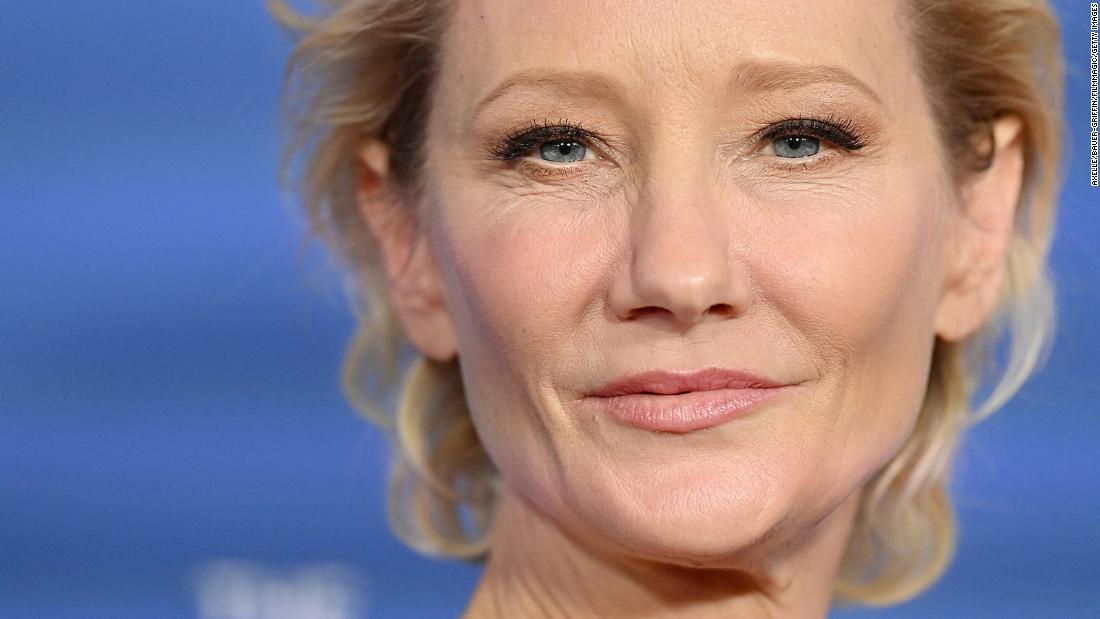 Anne Heche is in a coma in critical condition after a fiery car crash on Friday