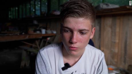 Injured by war, the scars on Ukraine&#39;s wounded children are more than skin deep 