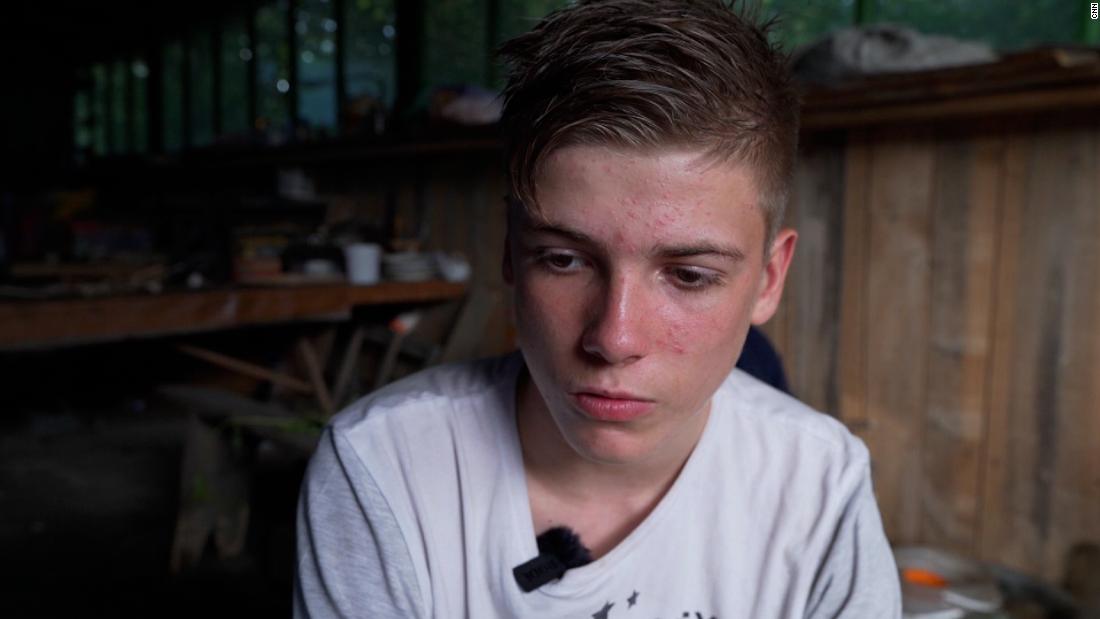 Video: Ukrainian teen shows shrapnel wounds he got while waiting in line for food