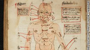 Gruesome medieval remedies revealed in resurfaced manuscripts