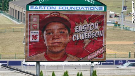 Little League World Series player critically hurt in bunk bed fall no longer under sedation