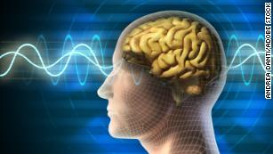 Brain stimulation improves short-term memory in older adults for a month, study finds