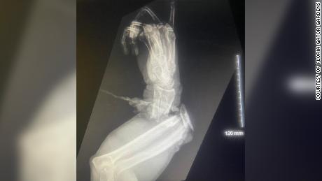 Rentgenový snímek ukazuje poškození Grazianiho paže