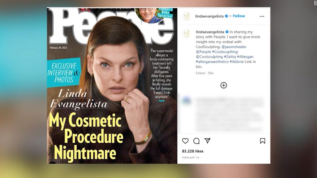 Celebrity plastic surgeon weighs in on Linda Evangelista’s cosmetic procedure nightmare and offers other options – CNN Video