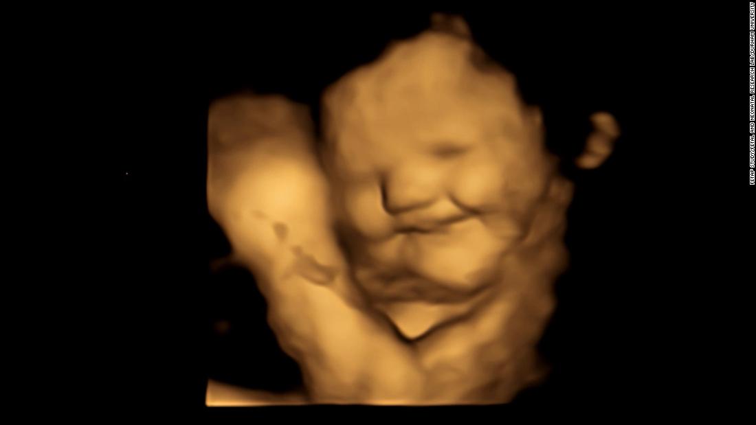 Fetuses smile for carrots however grimace over kale, examine suggests