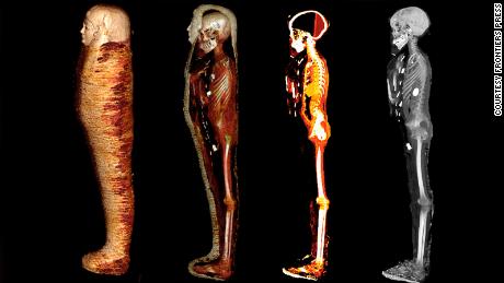 CT scans were used to virtually unwrap the mummified remains. 
 