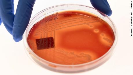 Climate change is contributing to the rise of superbugs, new UN report says 