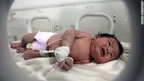A baby girl receives treatment inside an incubator at a children&#39;s hospital in Afrin, Syria, on Tuesday.
