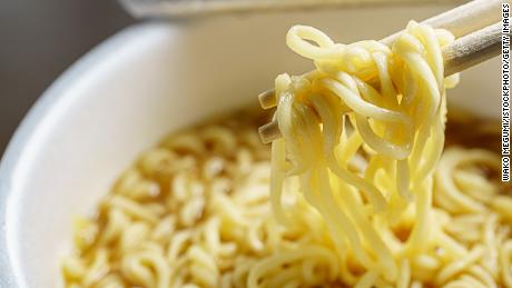 A new study has found almost a third of pediatric burn patients admitted to the University of Chicago&#39;s Burn Center over 10 years were burned while preparing instant noodles.