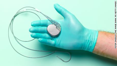 Cardiac implants - which may include pacemakers - were among the medical implants taken from deceased patients and reused.
