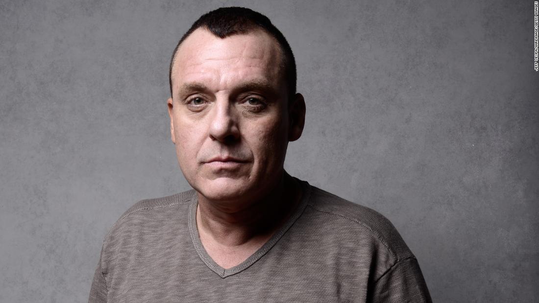 Tom Sizemore, 'Saving Private Ryan' actor, in critical condition after brain aneurysm, rep says