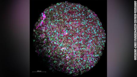 This magnified image shows a brain organoid produced in Hartung&#39;s lab. The culture was dyed to show neurons in magenta, cell nuclei in blue and other supporting cells in red and green.