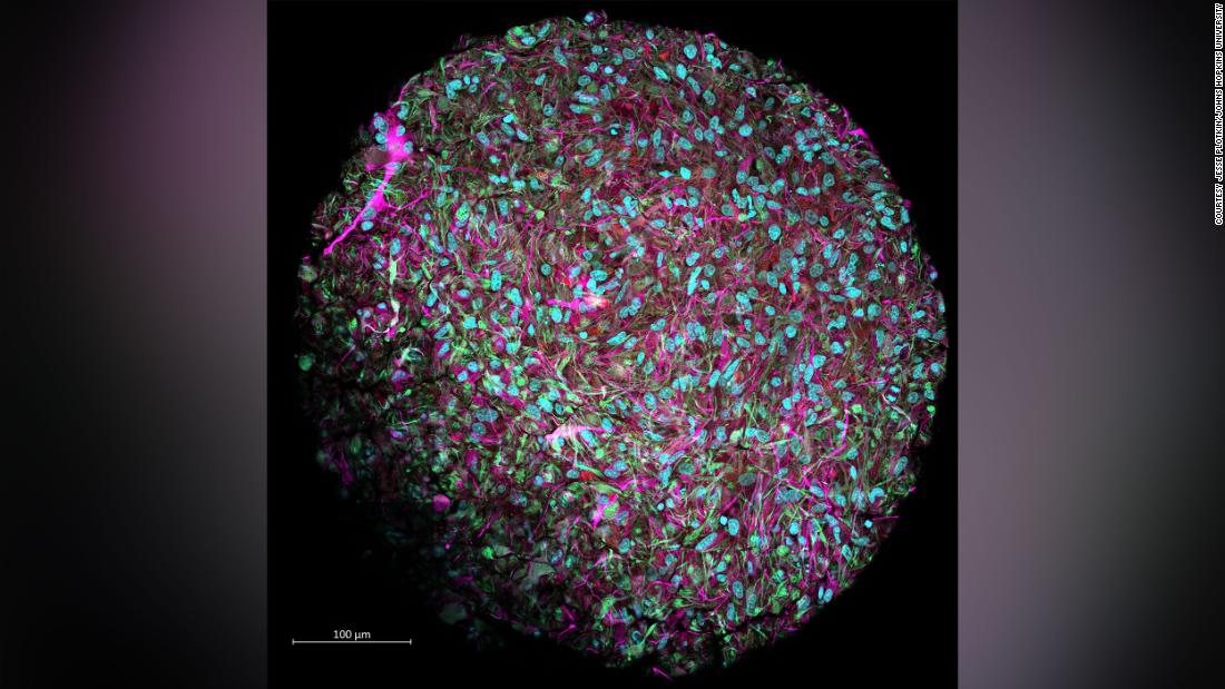 'Organoid intelligence' could create brain cell-powered computers