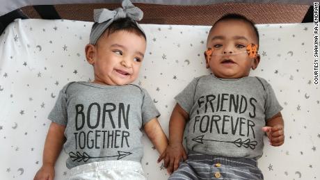 Adiah and Adrial Nadarajah set a record for the most premature and lightest twins ever born.