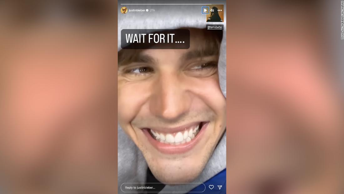 Justin Bieber all smiles with facial paralysis update