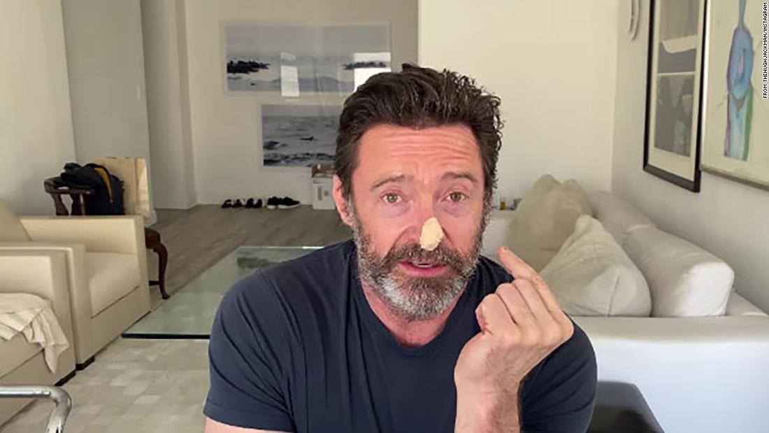 Hugh Jackman se hace pruebas de cáncer de piel y promueve la protección solar