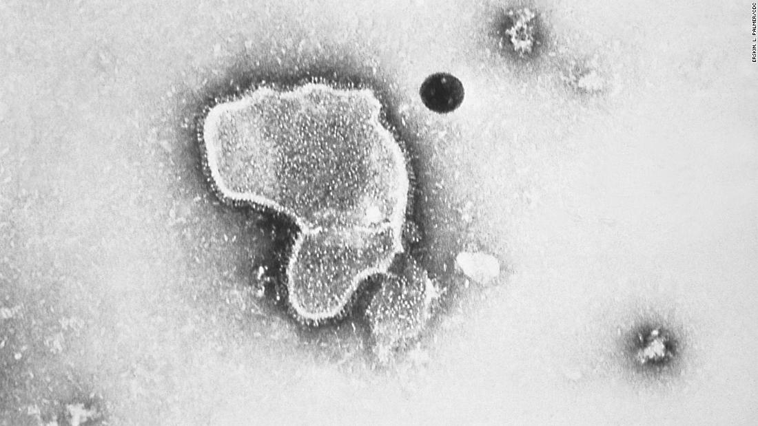 NextImg:Late-stage RSV vaccine trials show 'exciting promise,' some scientists say