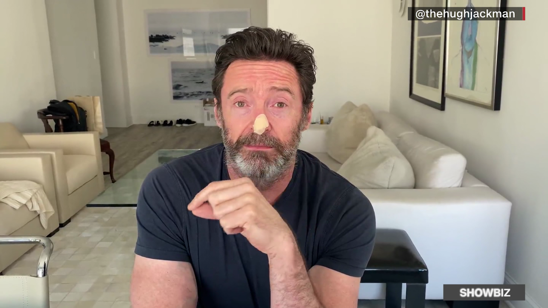 Hugh Jackman Se Somete A Pruebas De Cáncer De Piel Cnn Video