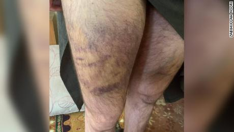 يقول نوري إن آسريه من طالبان ضربوه على ساقيه وظهره بقضيب معدني.