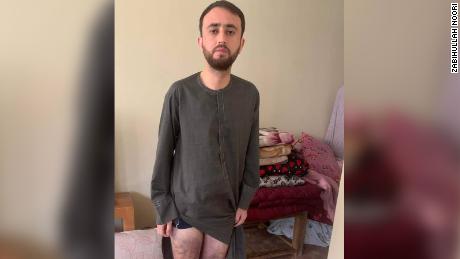 ذبيح الله نوري ، 27 سنة ، يظهر كدمات على ساقيه يقول إنها أصابتها حركة طالبان.