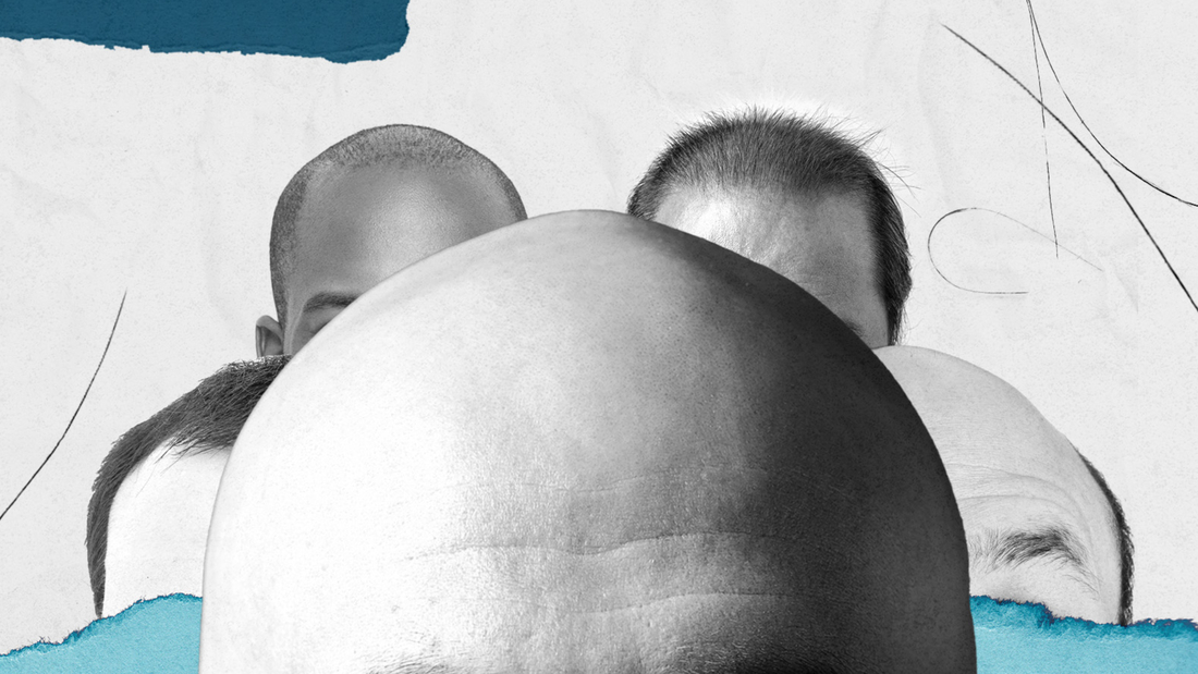 ‘Welcome to the sexy zone’: How to go bald gracefully