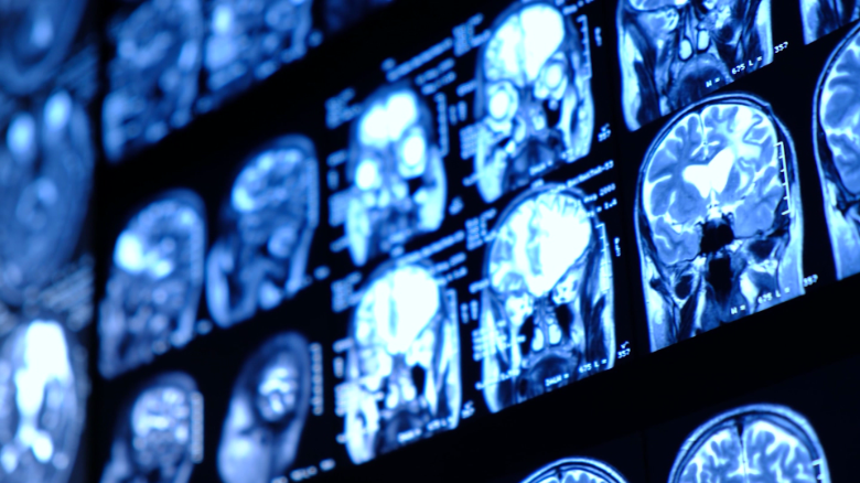 Neuroscientists test out brain-reading AI on CNN reporter