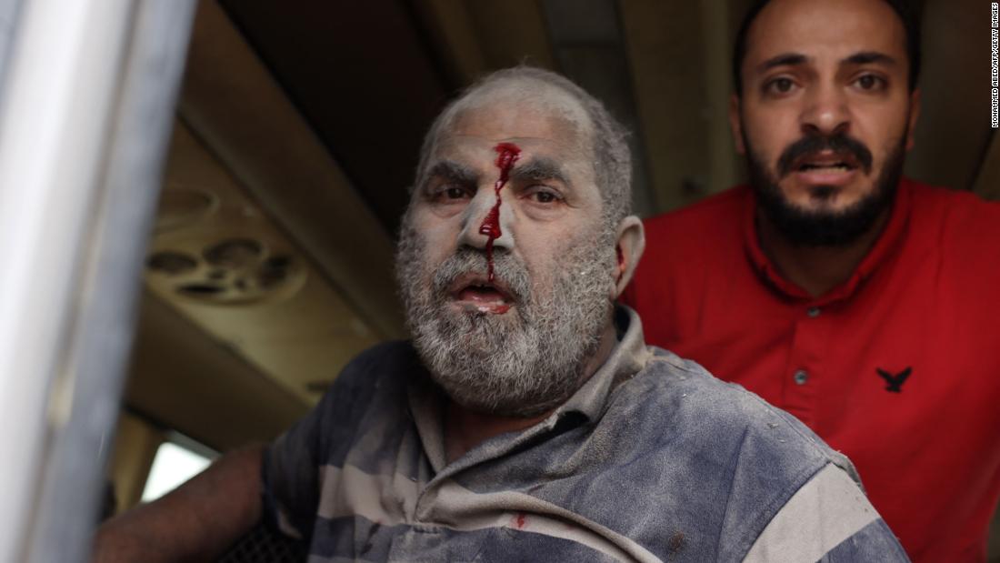 An injured man is covered in dust in the aftermath of Israeli bombing in Rafah, southern Gaza, on October 29.