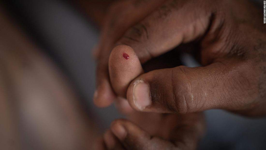 A volunteer doctor brought his own kit to do blood tests at the Durumi camp